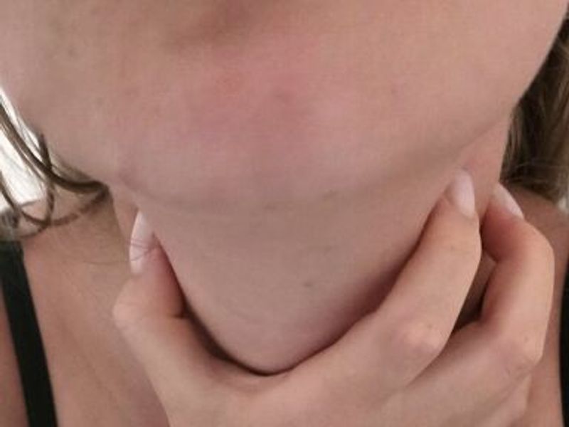 Squirt Katte — foto 2